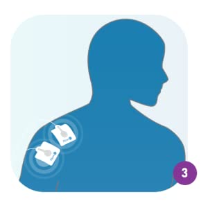 electrode pads to place almost anywhere