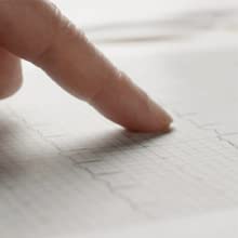 Record your own ECG, anywhere and anytime, with AliveCor's KardiaMobile and KardiaMobile 6L.