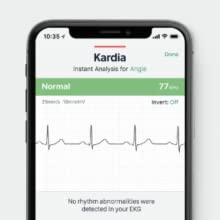 Record your own ECG, anywhere and anytime, with AliveCor's KardiaMobile and KardiaMobile 6L.