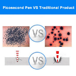 Tattoo Removal Picosecond Pen