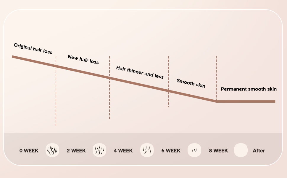 ipl hair removal device