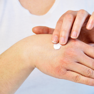 Diomed Doublebase Dry Skin Emollient