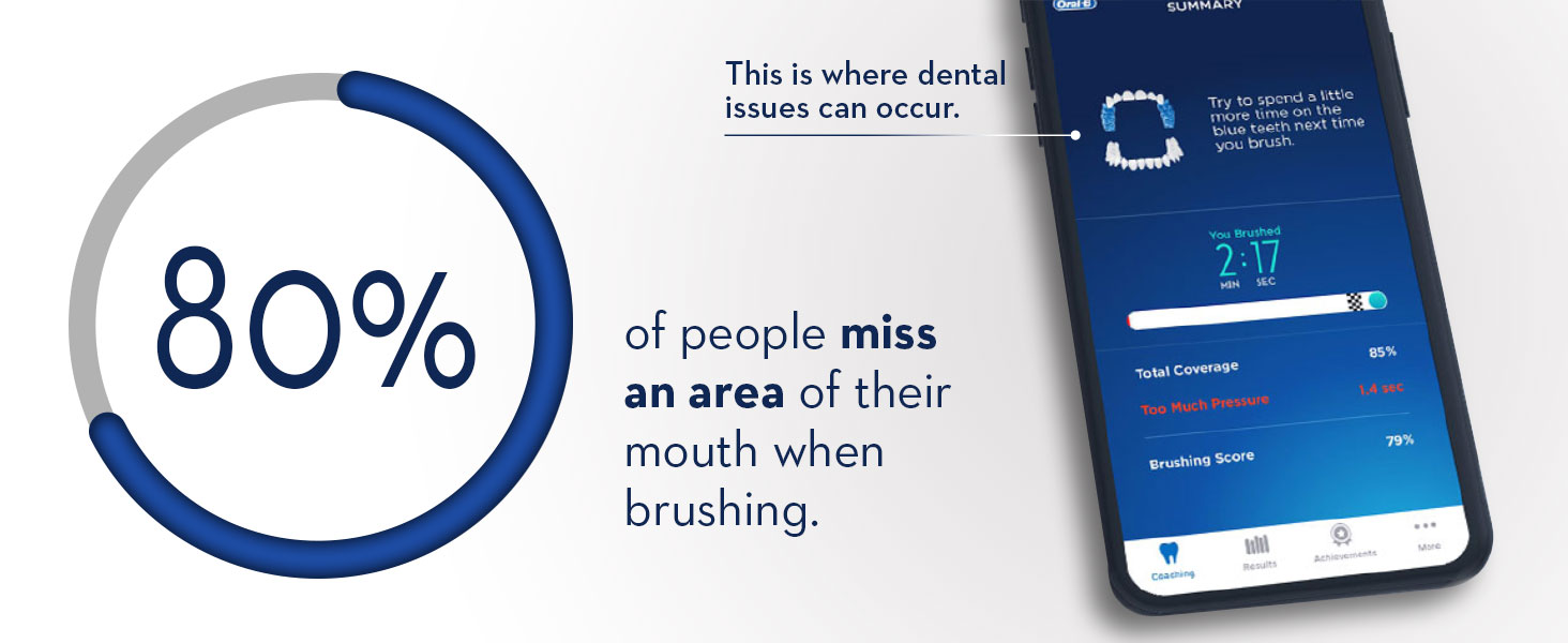 Genius X Rose Gold Luxe electric toothbrush