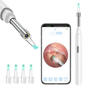 Zupora Ear Camera Ear Wax Remover Camera