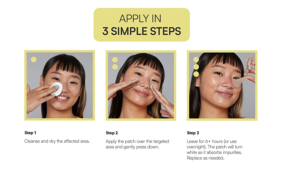 nose strips blackhead