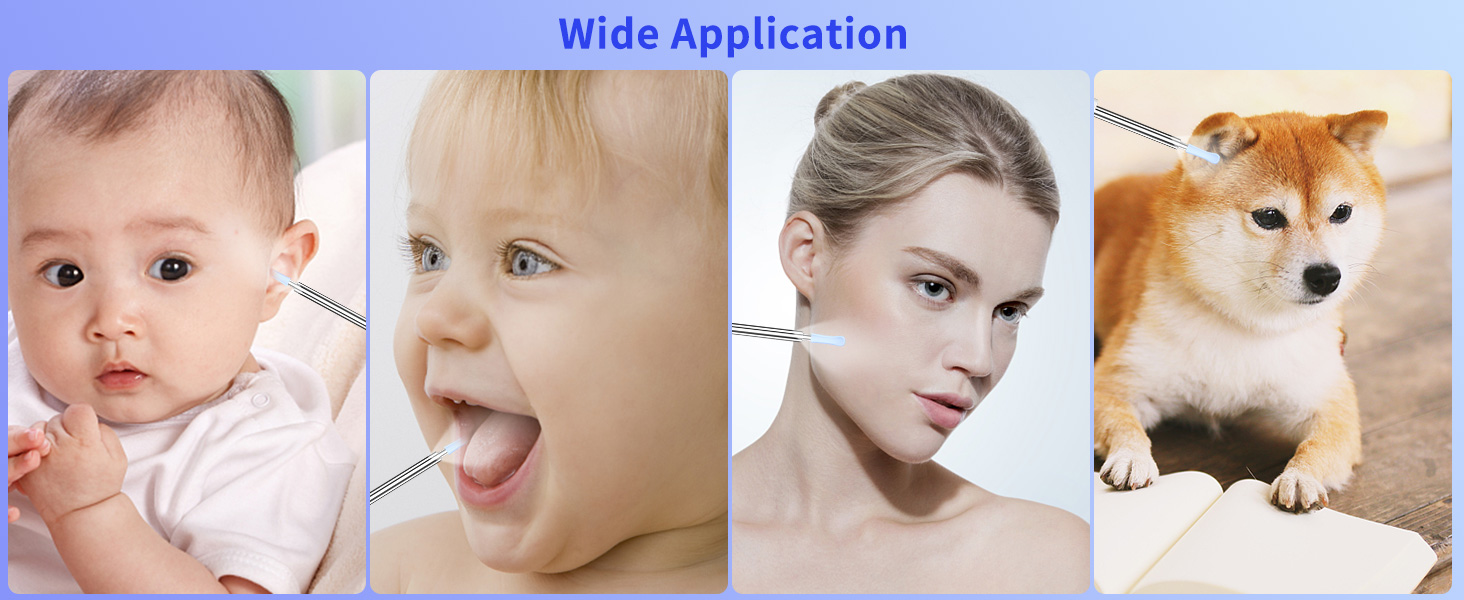 otoscope