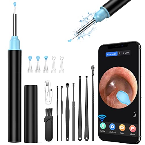Ear Wax Removal Kit Camera