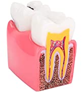 Bedwetting Alarm, Urine Bedwetting Alarm, Arm Wear Moisture Sensor Bed Wetting Alarm with Sound a...