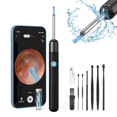 Ear Wax Removal Kit 1080P Wireless Otoscopes Earwax Removal - Keystone 4