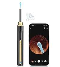 ear wax removal tool; ear wax removal; earwax remover tool; ear wax removal kit camera;