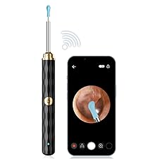 ear wax removal tool; ear wax removal; earwax remover tool; ear wax removal kit camera;