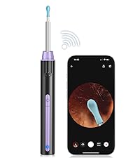 ear wax removal kit; ear wax remover tool with camera; ear wax remover; ear wax camera;