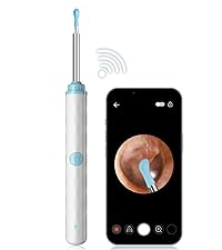 ear wax removal kit; ear wax remover tool with camera; ear wax remover; ear wax camera;