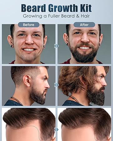 BEARD GROWTH KIT