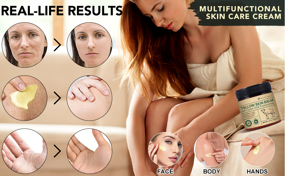 Tallow Castor Oil Frankincense Oil Handmade Skin Balm